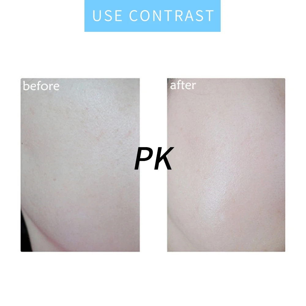 

100ml Yeast Hyaluronic Serum Facial Moisturizing Firming Oil Control for Oily Skin Care