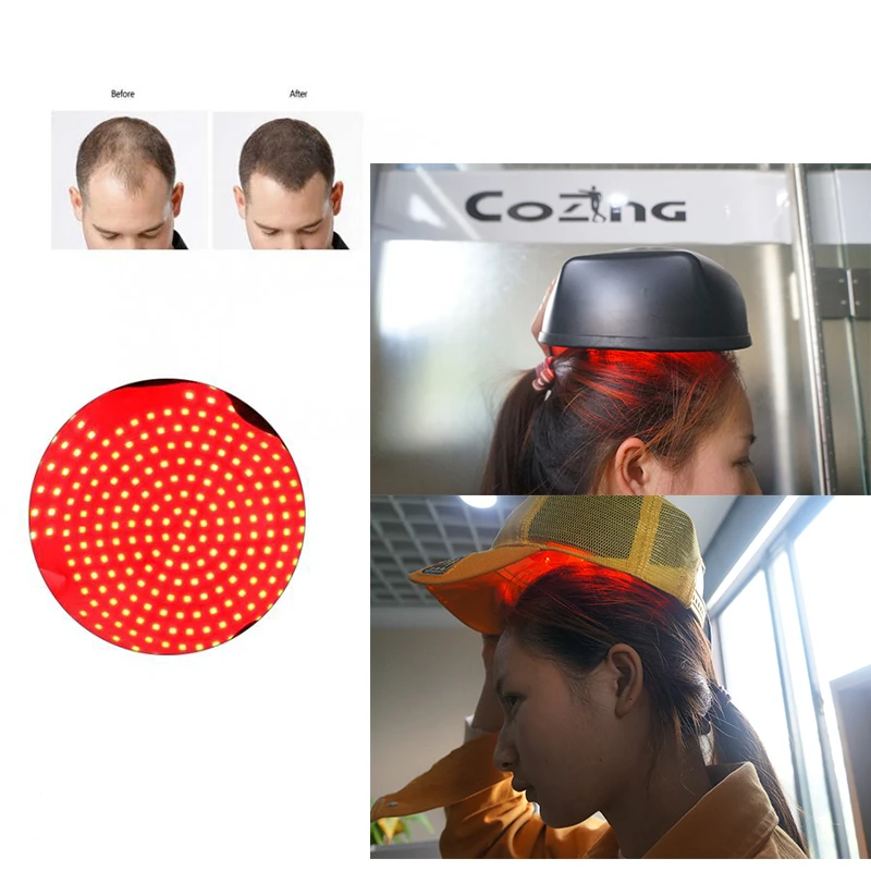 Electric Laser Hair Growth Cap Anti Hair Loss Treatment Infrared Nano Red Light EMS Vibration Scalp Massage Hair Brush