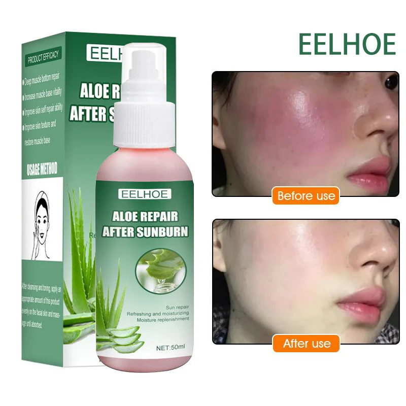 

Aloe Vera Repairing Sunburn Face Serum Dryness Skin Moisturizing Essence Oil Control Anti Acne Whitening Nourishing Facial Care