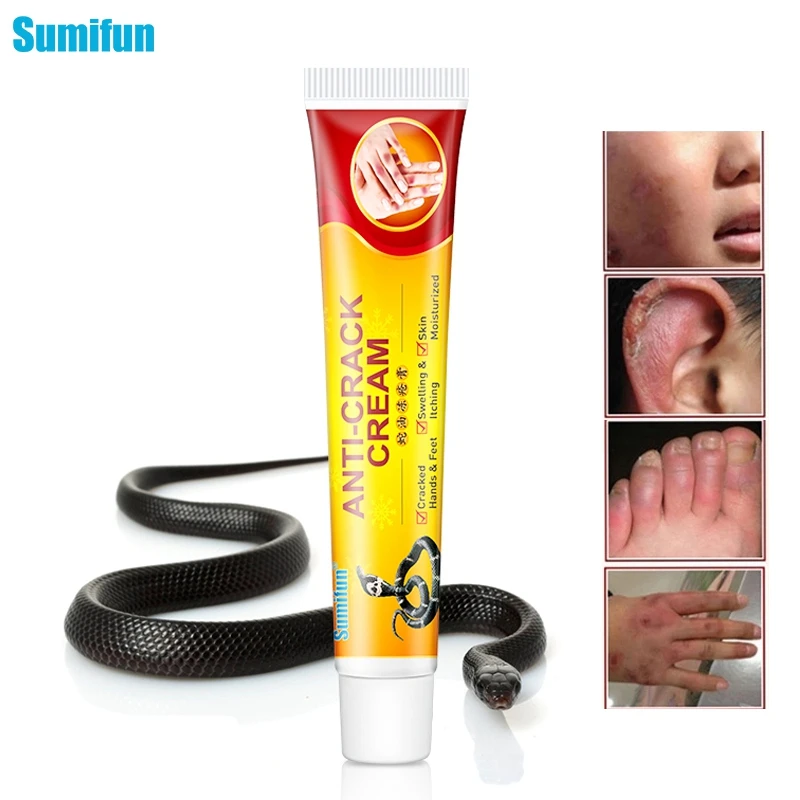 

1 шт., мазь для снятия симптомов мозолей на каблуках