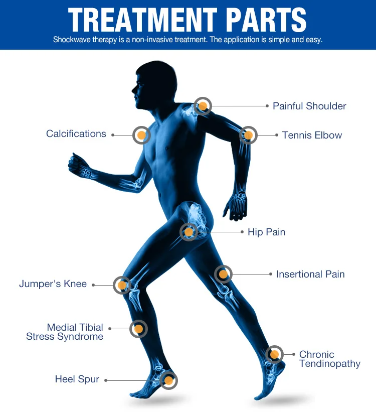 Компрессор нового поколения 8 бар устройство радиального типа ESWT экстракорпорея