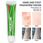 Крем от экземы, крем от псориаза для кожи, мазь от дерматита, экзематоида, экземы, крем для лечения псориаза, крем для ухода за кожей, крем для тела