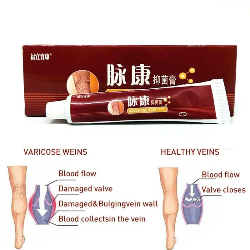 

1pc Varicose Veins Treatment Cream Relief Veins Pain Phlebitis Legs Varicosity Angiitis Remedy Ointment Health Care