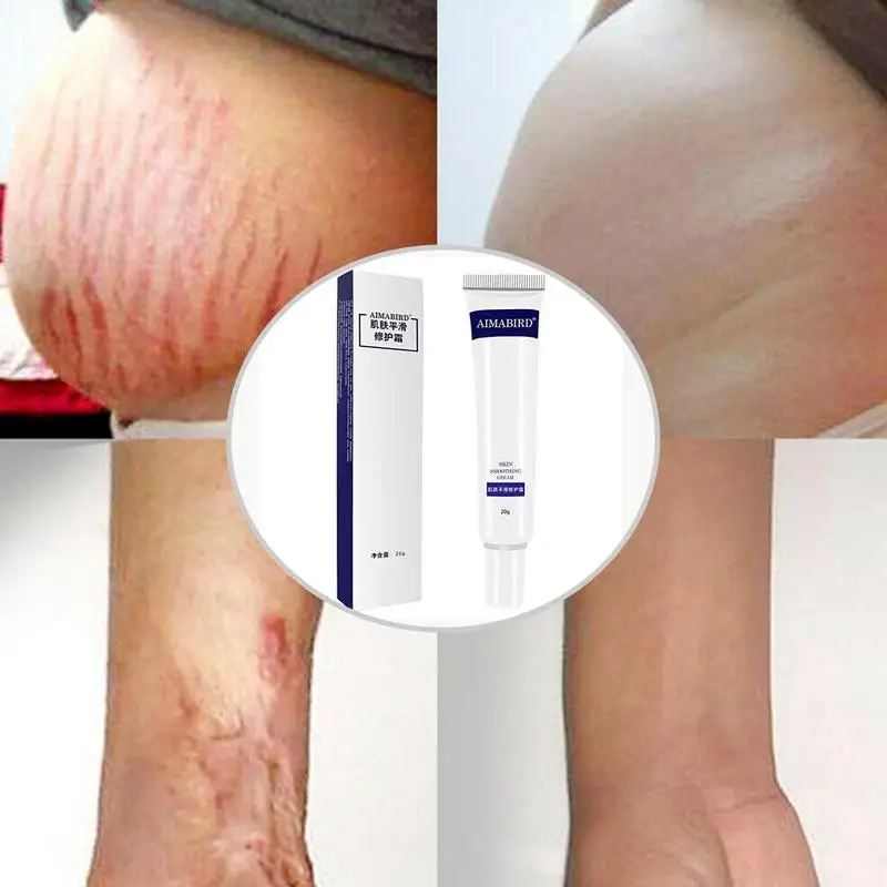 

20g Powerful Remove Pregnancy Scars Cream Stretch Marks Creams Treatment Repair Winkles Firming Body Maternity Anti S9L6