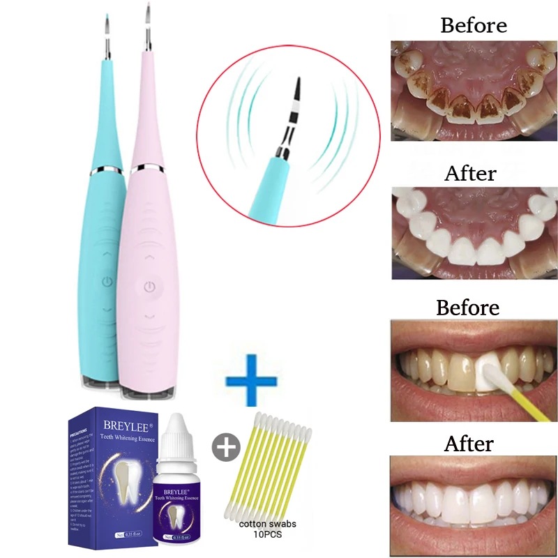Портативный электрическая звуковая детали стоматологического аппарата для
