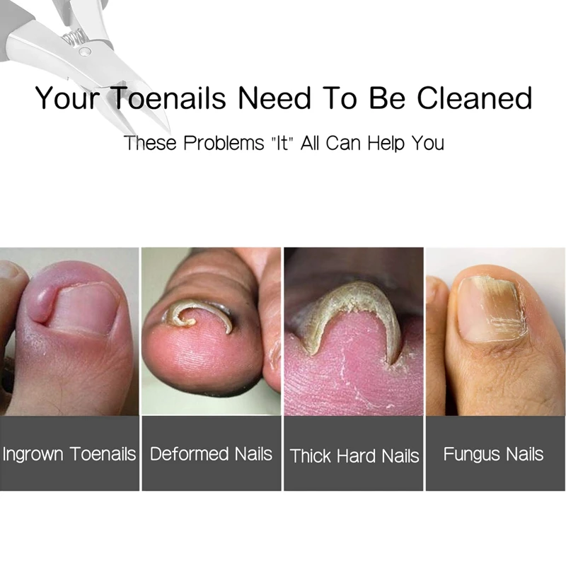 Вросшие кусачки для ногтей используемые толстых грибков вросших ногтей. Длинная