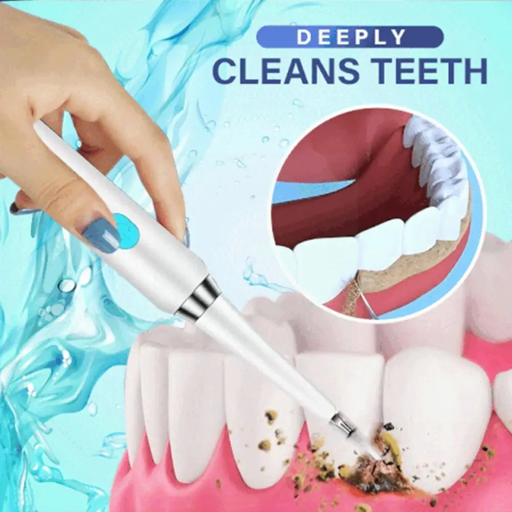 

Electric Ultrasonic Sonic Tooth Cleanser Tooth Stone Tool Tartar Tooth Care Tool Whitening Stains Removal Remove Dental Sca R0S7