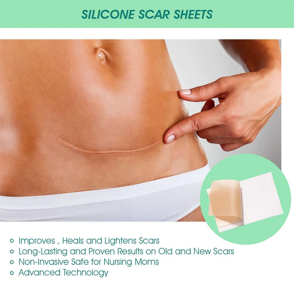 

Efficient Surgery Scar Removal Silicone Gel Sheet Therapy Patch for Acne Trauma Burn Scar Skin Repair Scar Treatment Support CSV