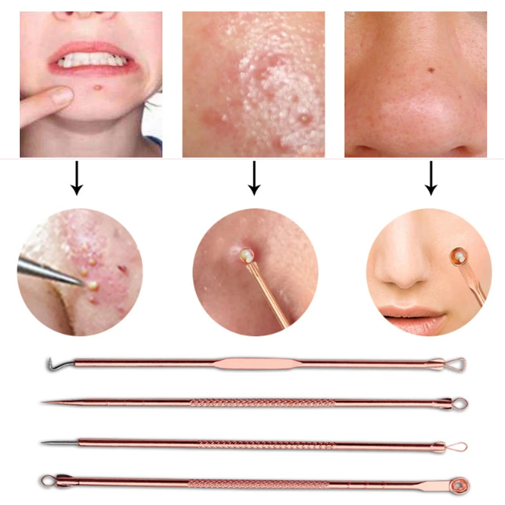 4 шт. экстрактор угрей прыщи инструмент для удаления ложка лица набор игл черные