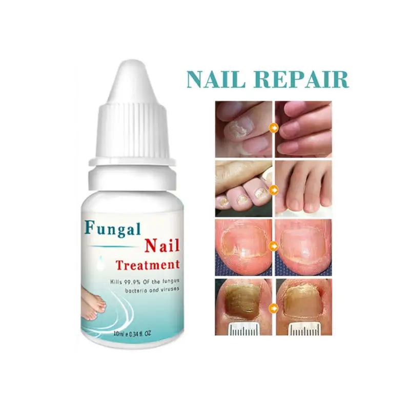 Жидкость для лечения Ногтей lantome 10 мл отбеливание ногтей и ног | Красота здоровье