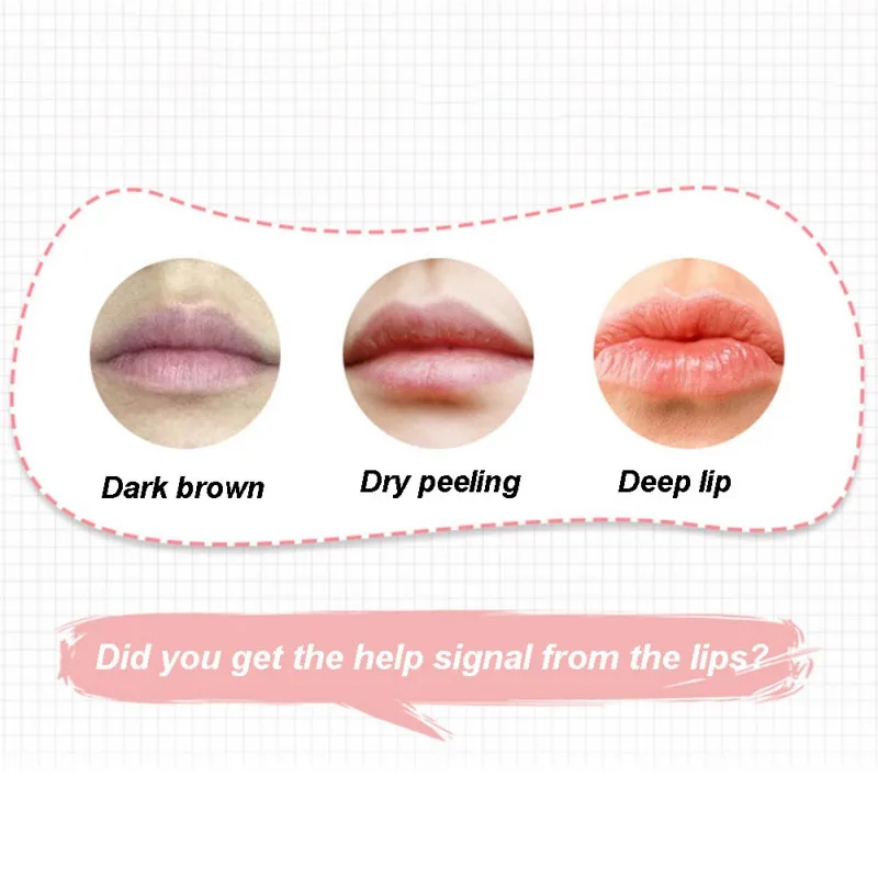 Модный милый увлажняющий бальзам для губ осветляет тонкие линии цвет кожи