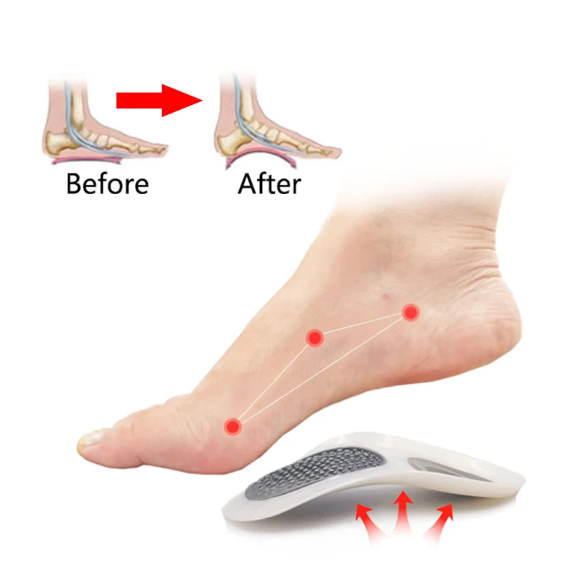 

Ортопедические стельки для плоскостопия, поддержка свода стопы X/O, силиконовые вставки для обуви, для мужчин, женщин, мужчин, ортопедические...