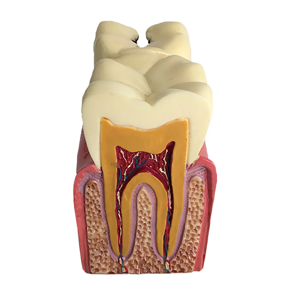 

Teeth Removable Tooth Model Caries Demonstration Teeth Model for Study