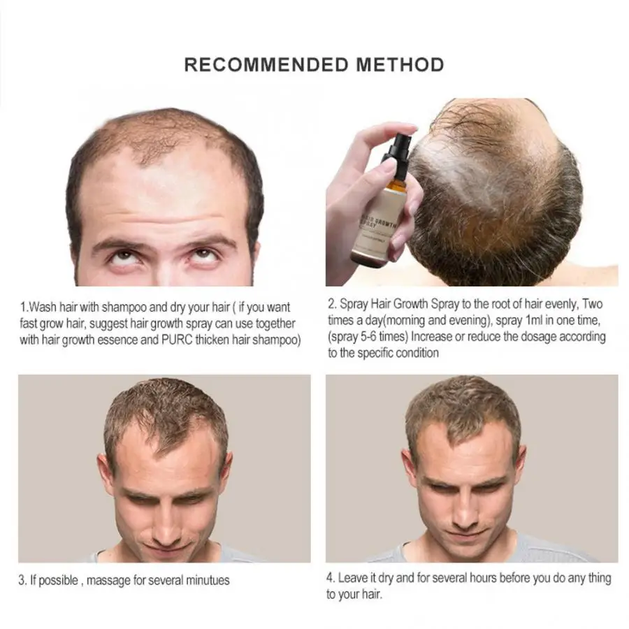 

Beard Growth Herbal Extract Hair Growth Spray Anti Hair Loss Treatment Liquid Hair Care Tool 30ml Hair Products
