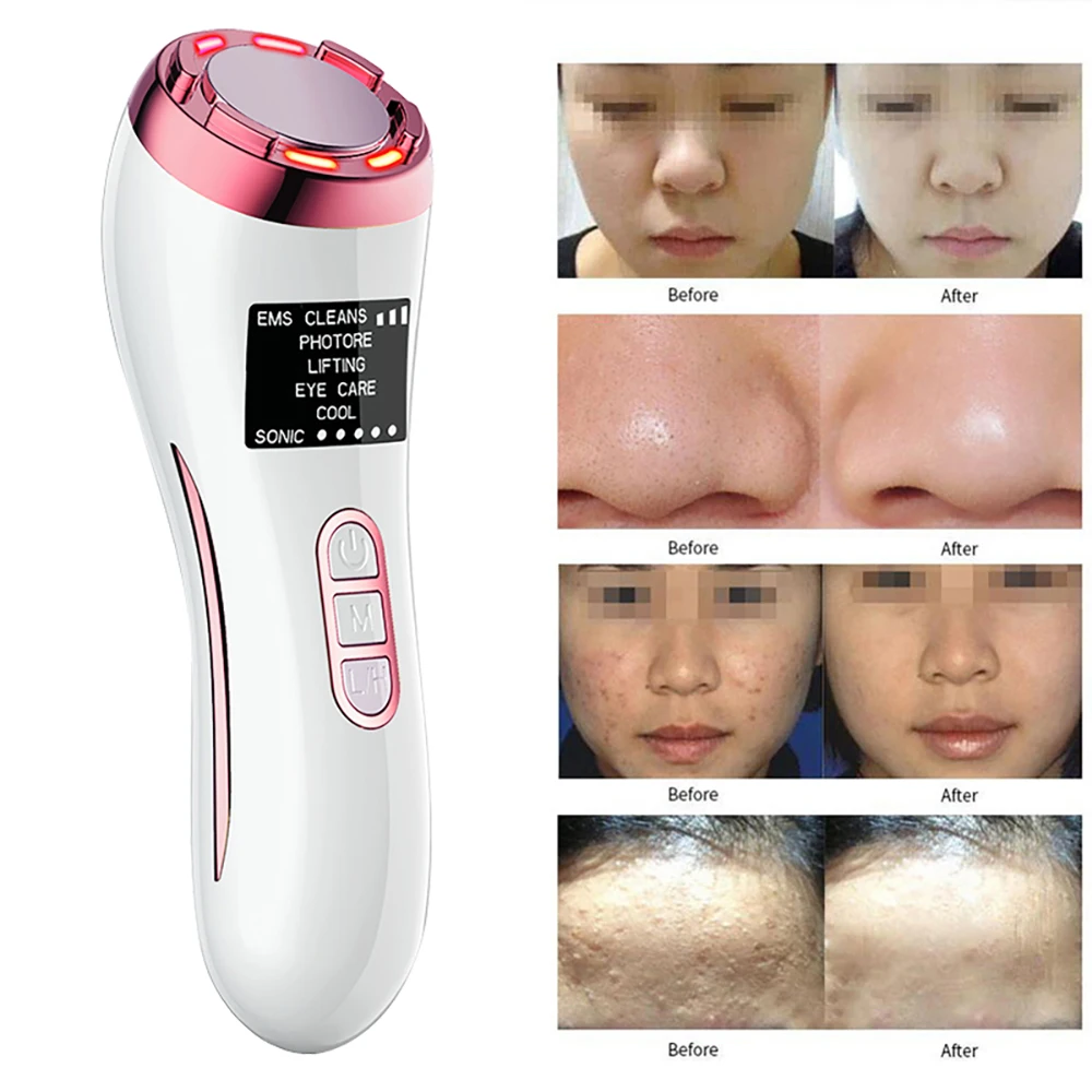 

EMS LED Photon Therapy Sonic Vibration Wrinkle Remover Hot Cool Treatment Anti Aging Facial Massage Skin Care Beauty Device