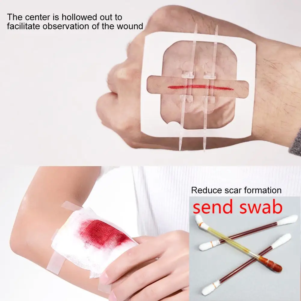 Пластыри на молнии для безболезненного закрытия РАН пластыри ран без швов