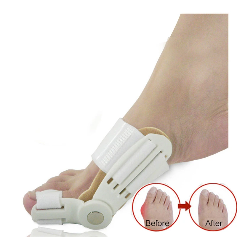 

1 pairs Big Toe Separator Hallux Valgus Orthopedic Bone Finger Pedicure Corrector Splint Correction Bunion Thumb Foot Care Tool