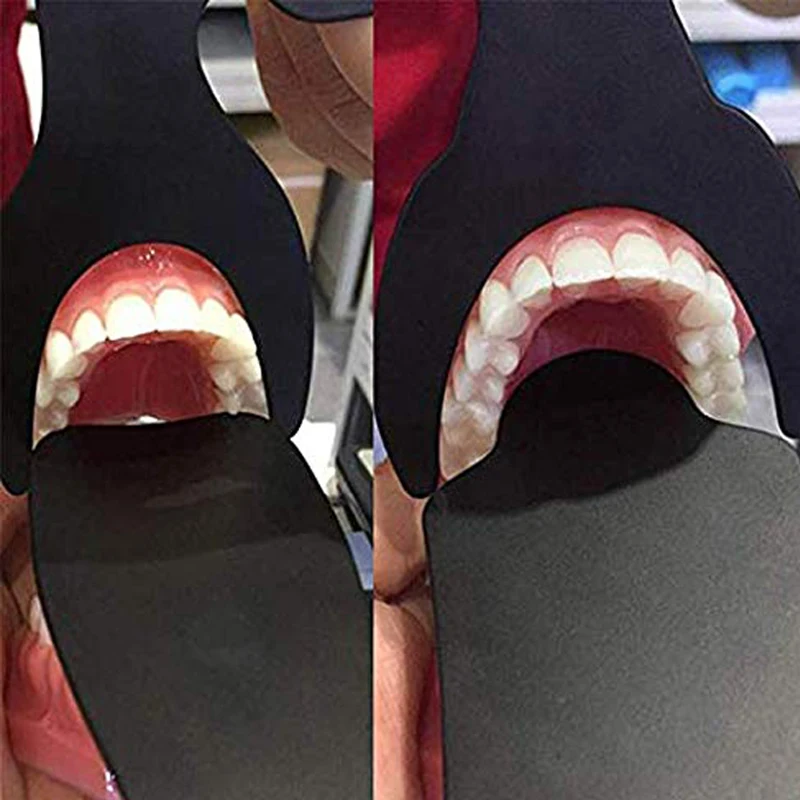 Dental Photo Contrast kit Dental Oral Imaging Black Background Board Palatal Contrast 4pcs/set