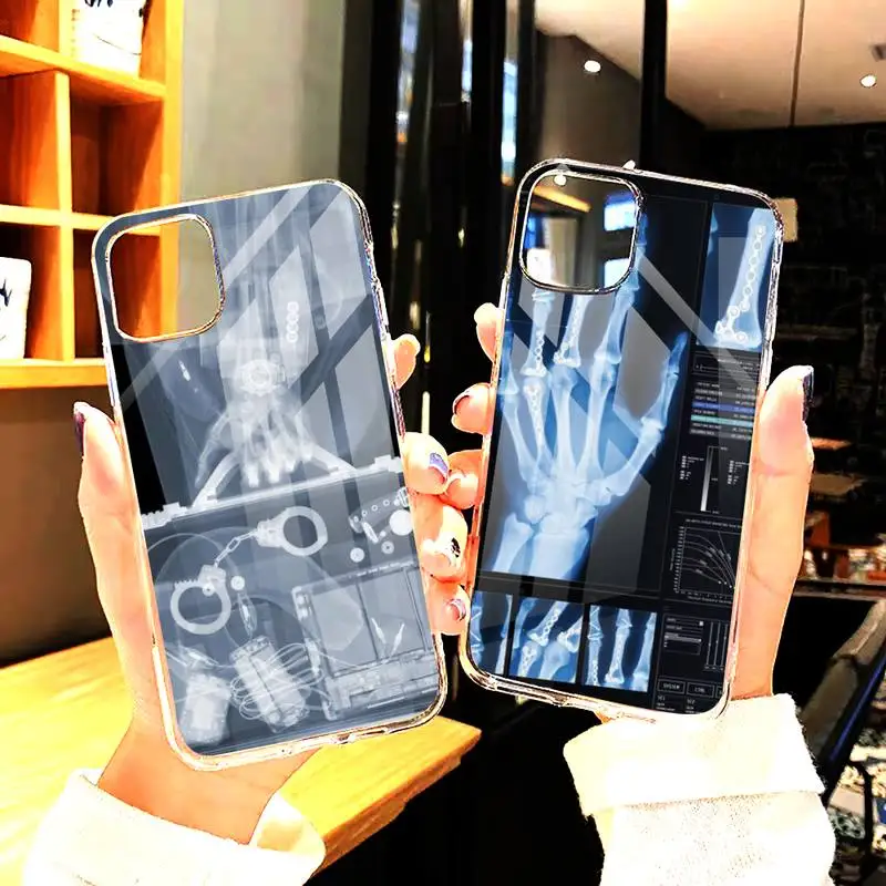 

Radiological human organs Phone Cases Transparent For iphone12 11 Pro Max X XR XS MAX 7 8 6 6s plus 5s se 2020 Cover