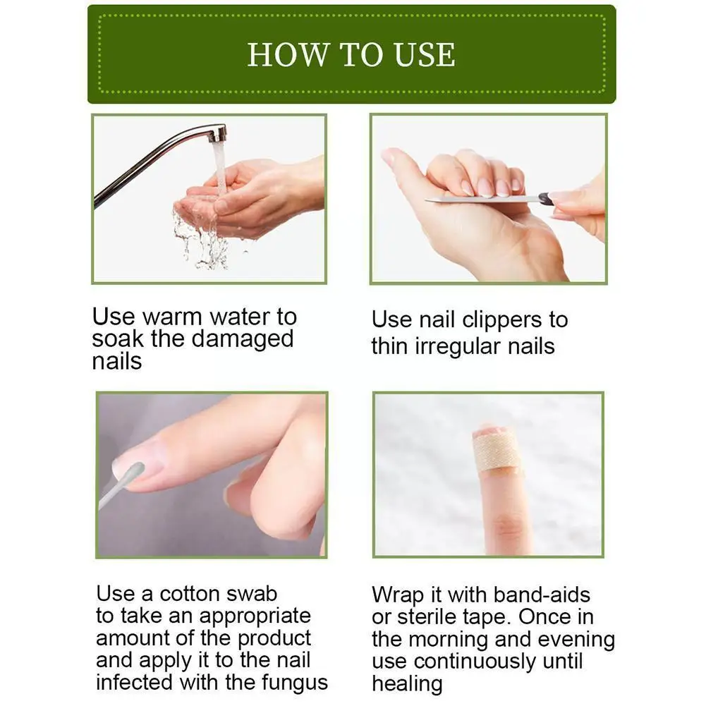 

1pcs Nail Fungal Treatments Nail Repair Essences Serum Treatments Paronychia Removal Care Nail Gel Onychomycosis Foot Fungu R2X9