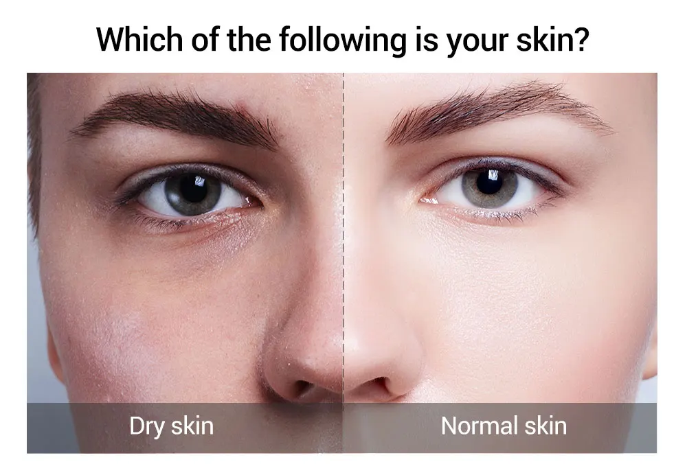 Retinol 2.5% Vitamin C / A Facial Anti Wrinkle Serum Remove Dark Spots Collagen Whitening Face Aging Essence | Красота и здоровье