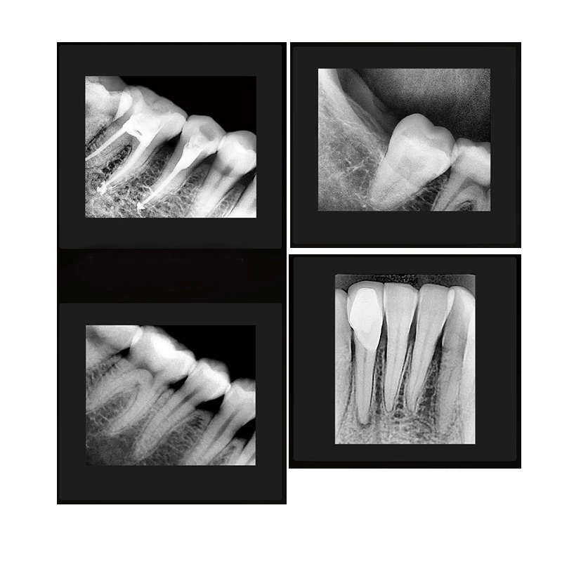 Портативное стоматологическое оборудование rx Dental Xray Digital Sensor Imaging System radiovisografo Dental Intraoral raps x RVG Senor Dentist (art.: 3920cde41fd62) - 3920cde41fd62