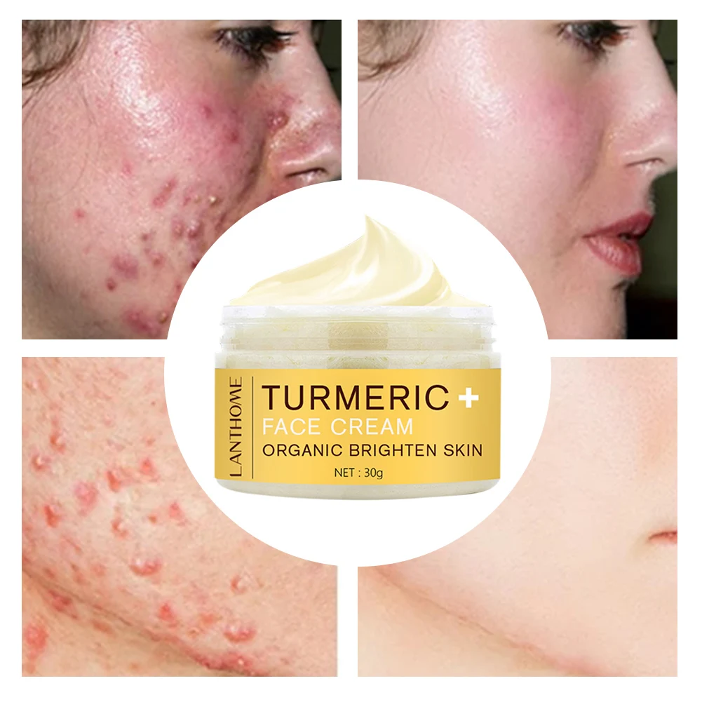 

Turmeric Face Cream Anti-Aging Skin Moisturizer For Dullness Uneven Skins Heavy Pores Face Cream For All Skins Facial Care Sets
