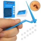 Набор для удаления бородавок с микрокожей, устройство для удаления бородавок с мяса, Кротов, кукурузы и бородавок, резиновое кольцо, этикетка для ухода за кожей