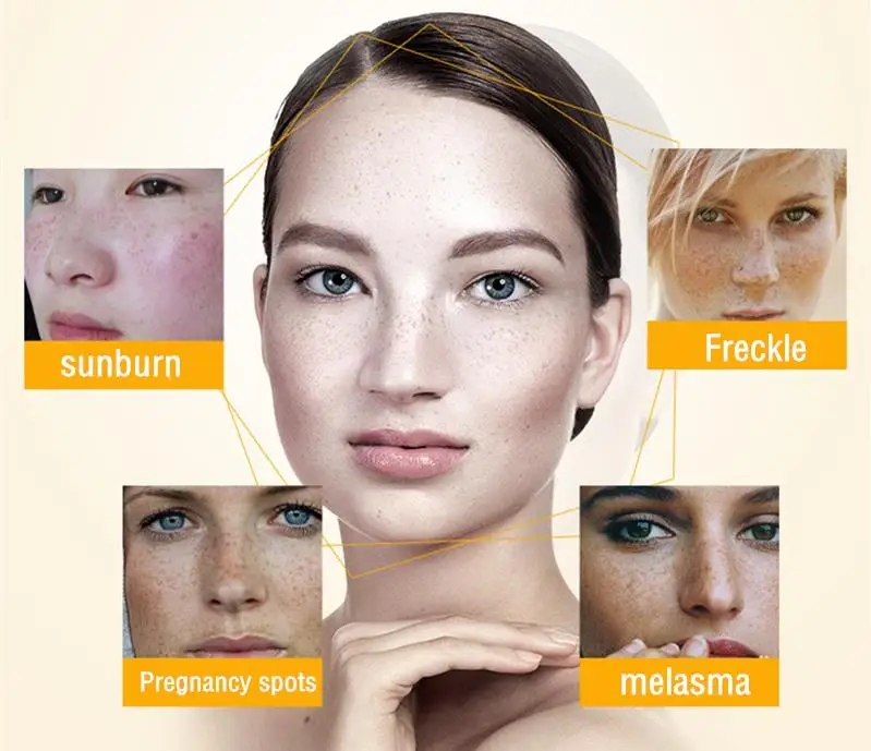 

COSRX AC Collection Ultimate Spot Cream 30g Face Cream Removal Freckle Melasma Pigment Melanin Pregnancy Spots Facial Acne Cream