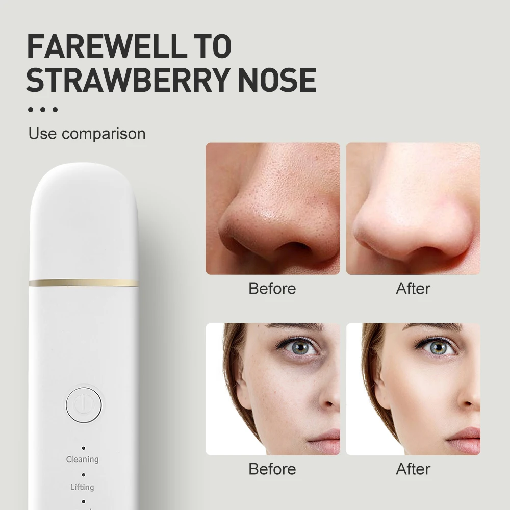 

Ultrasonic Facial Skin Scrubber Facial Cleaner Machine Acne Blackhead Remover Peeling Shovel Cleaner Facial Massager Skin Care