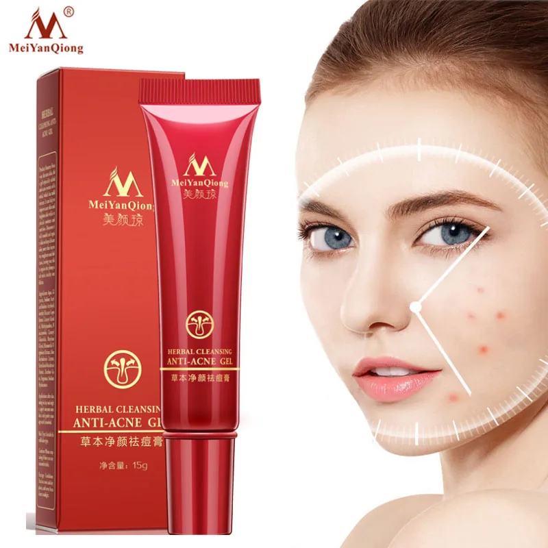 Травяное удаление акне Восстанавливающий увлажняющий крем для лица Питательный