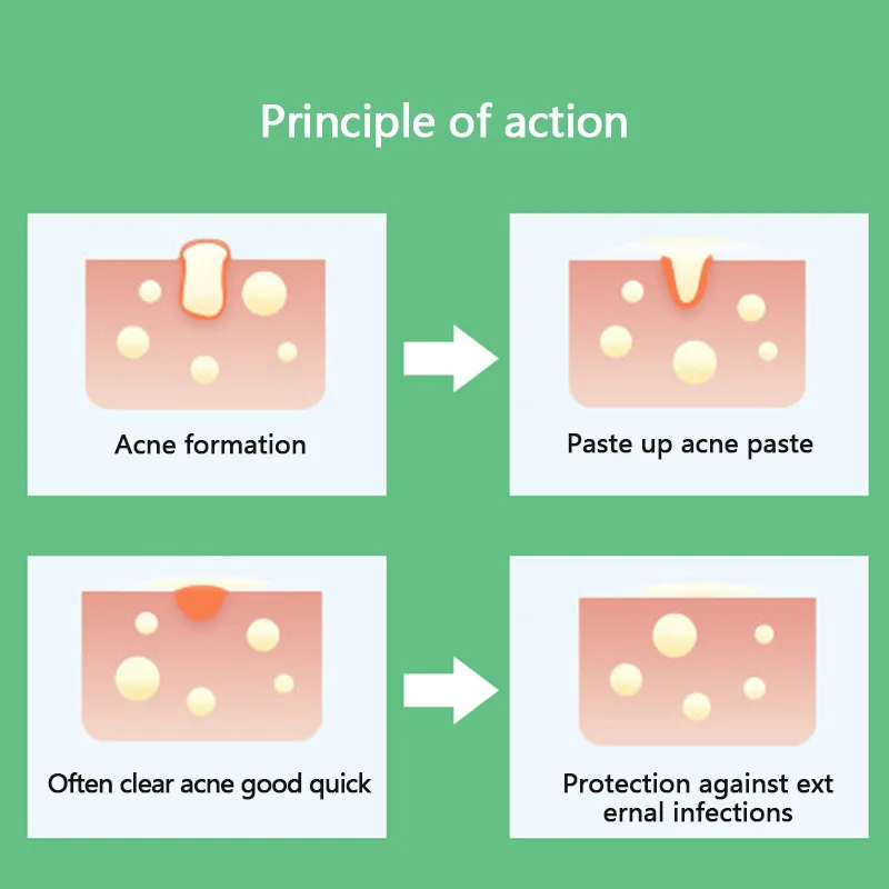 24 шт. Гидроколлоидные прыщи невидимые мастер патч снятие наклейка накладки