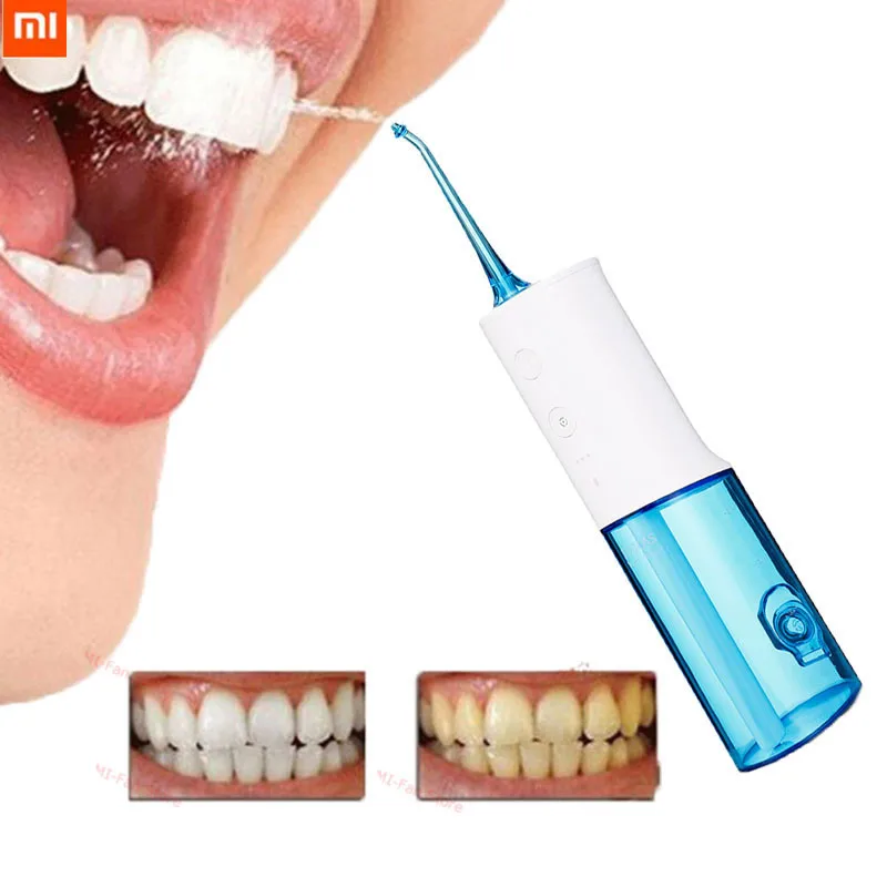 Ороситель для полости рта Xiaomi Soocas W3 резервуар воды 230 мл | Электроника