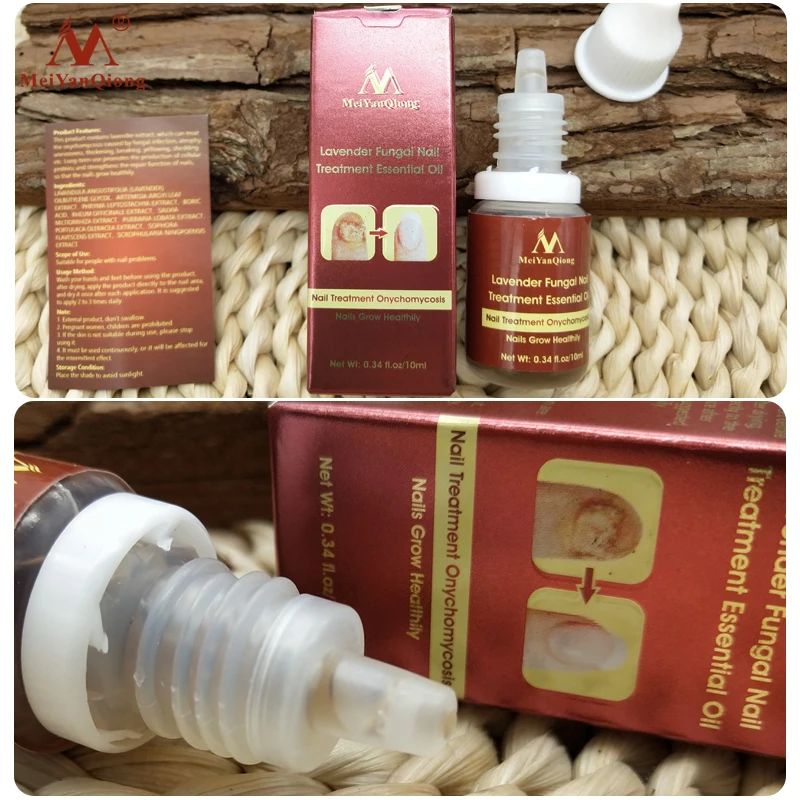 

Nail Fungal Repair Serum Care Treatment Onychomycosis Anti Infection Paronychia Toenails Nourish Brighten Hands Essence Oil 10ML