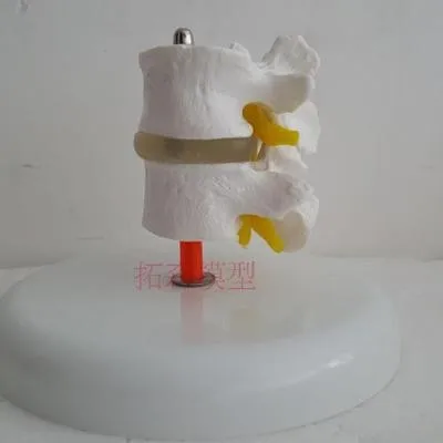 

Human skeleton model Medical Teaching Aids Lumbar model free shipping