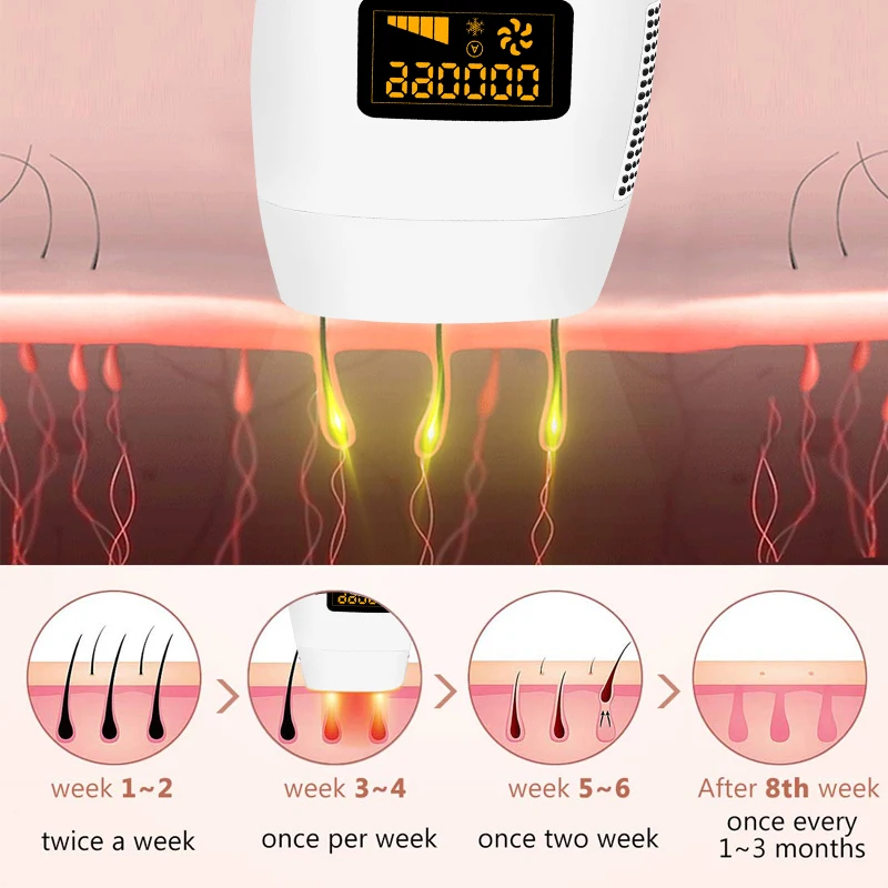 Фотоэпилятор для мужчин и женщин лазерный депилятор с IPL эффектом 990000 вспышек