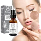 Сыворотка с гликолевой кислотой, 30% г., для смягчения пор, смягчения кутикулы, лечения акне, шрамов, антивозрастной отбеливающий раствор, увлажняющий раствор, 30 мл