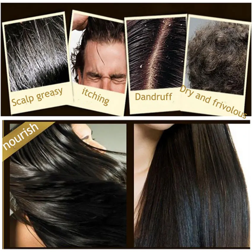 200 мл шампунь Multiflorum Китайский травяной удаление перхоти против выпадения волос