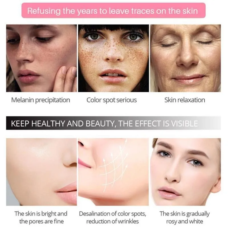Anti-freckle Cream Whitening Moisturizer Whitening Anti Wrinkle Cream Acne Scar Skin Sunscreen Acne Treatment Skin Care