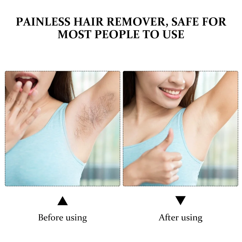 

1 set of Hair Removal Instrument Hair Remover Hair Removal Tool (UK Plug)