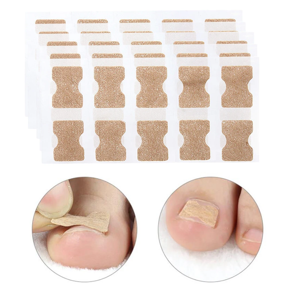 

Упаковываем 50 вросшие ногти для ног "францзуский маникюр" корректор обработки лента Уход за ногтями на ногах