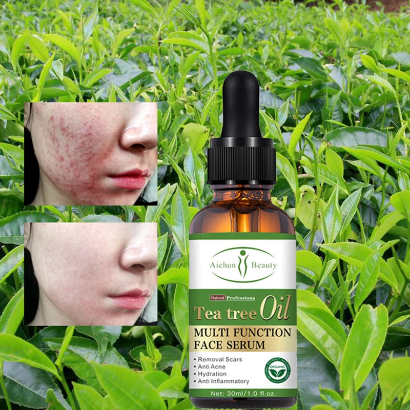 Ремонт уход за кожей лица Сыворотки 30 мл Чай дерево с эфирным маслом Fades акне Mark