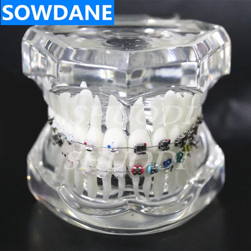 Стоматологическая Ортодонтическая модель 4 вида кронштейнов с керамическим