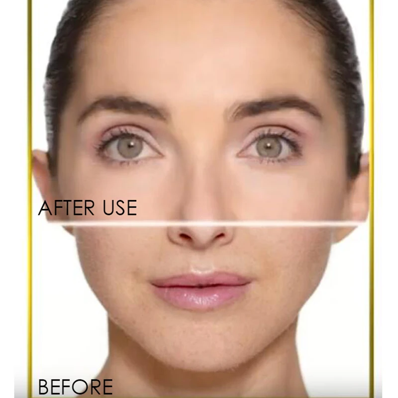 Dermaplane средство для удаления волос с подсветкой, для лица, Expoliator, электрическая бритва Леди, бритва для лица, бритва для волос, безболезненная, Expoliates, мертвая кожа