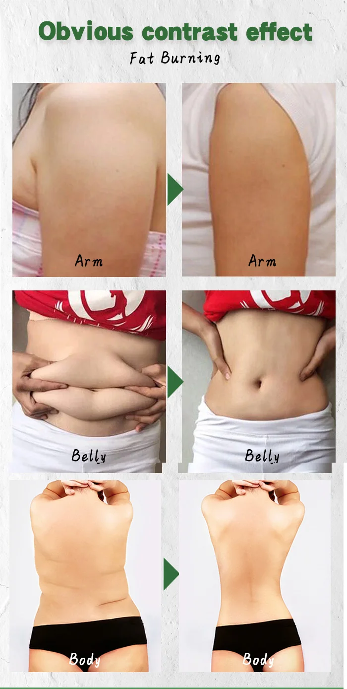 Крем для похудения средство снижения веса крем с тонкой талией тонкими ногами и