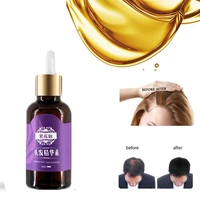 new 2021 ginger fast hair growth serum essential oil anti preventing hair lose liquid damaged hair repair growing