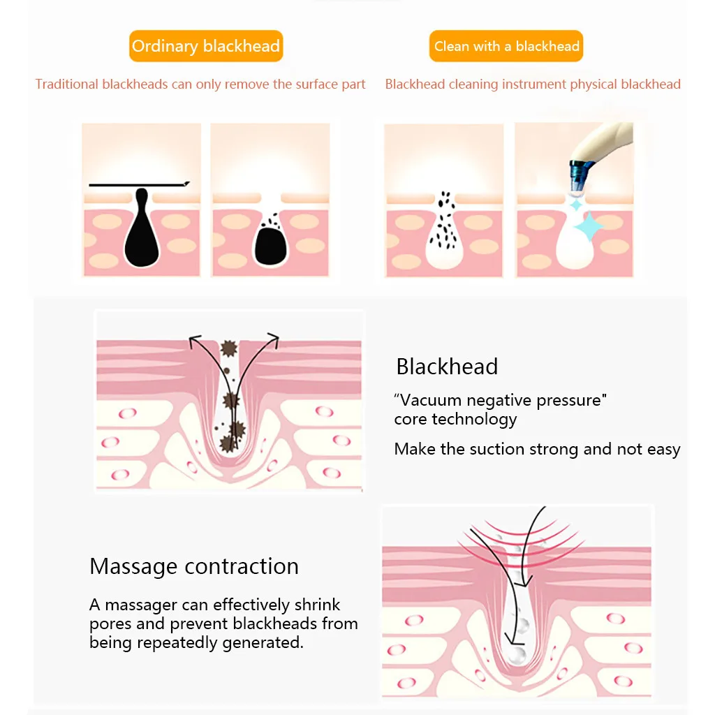 USB перезаряжаемое устройство для удаления черных точек вакуумный очиститель пор