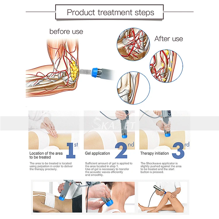 Высокая эффективность! Хорошее качество экстракорпоральная ударно волновая
