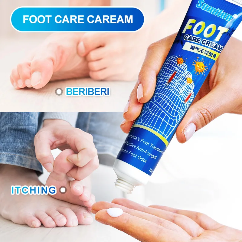 

Anti Fungal Infections Foot Ointment Inchacao Treatment Athlete Foot Beriberi Itch Erosion Peeling Blisters Feet Cream