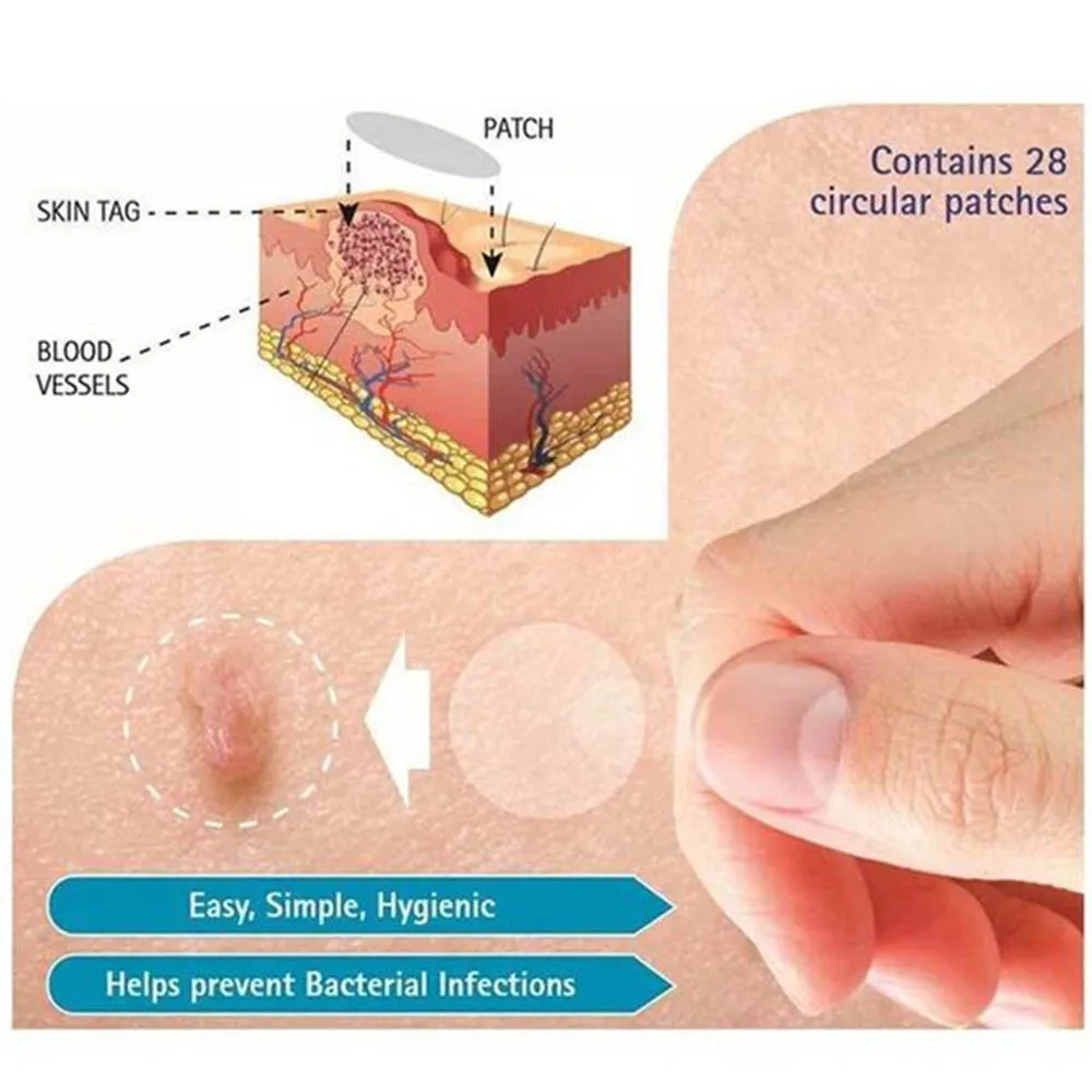 Skin Tag Remover Patch Ance Pimple Plaster Acne Cream Invisible Hydrocolloid Master Anti-infection Absorb Face Care |